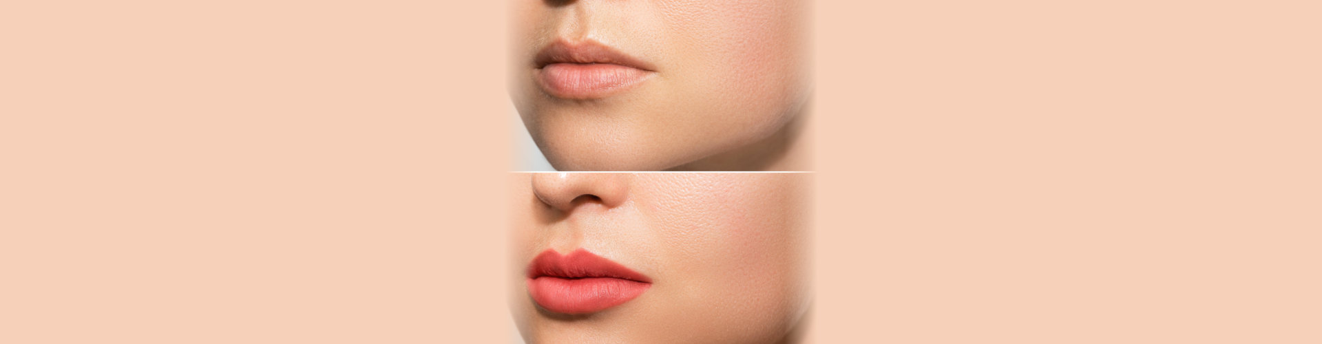 before and after comparison of the lips of a woman