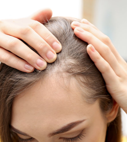 a woman with a hair loss problem