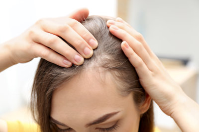 a woman with a hair loss problem